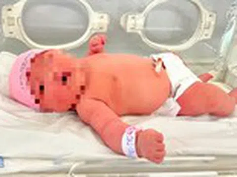 Bé gái chào đời nặng gần 6kg, nên cẩn trọng khi mang thai quá lớn