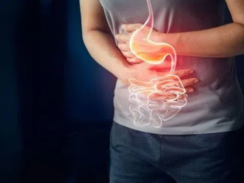 Thực phẩm cần tránh ăn khi bị trào ngược dạ dày