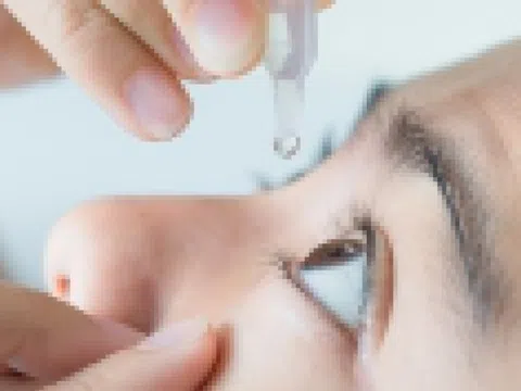 Cách nhỏ thuốc khi bị đau mắt đỏ