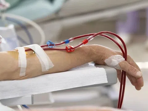 Khi thận suy giảm chức năng, những thực phẩm này không thể ăn