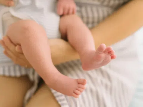 Dấu hiệu nhận biết trẻ bị còi xương