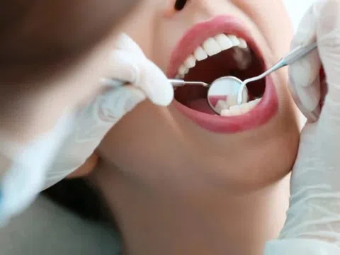 8 nguyên nhân khiến răng mọc lệch ai cũng cần biết