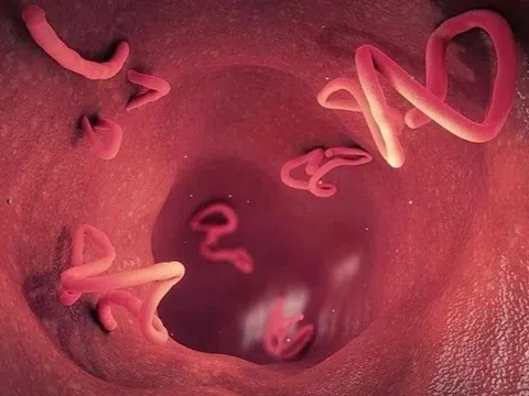 Trẻ dưới 2 tuổi có nên tẩy giun?