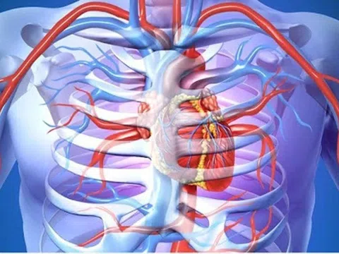 Cần phát hiện sớm dị dạng lồng ngực bẩm sinh