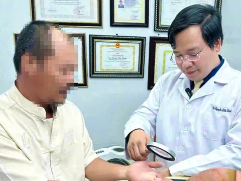 Người đàn ông mắc u hạt vì thú vui nuôi cá cảnh