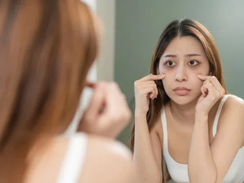 Không phải mỹ phẩm, đây mới là thứ quyết định làn da