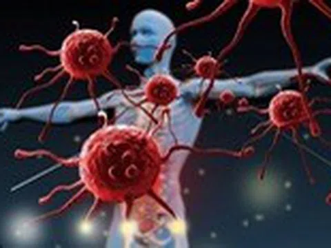 Những vị trí dễ bị ung thư mọi người nên biết để phòng ngừa