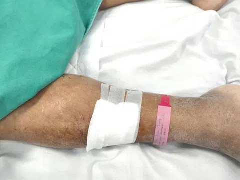 Tai nạn nhỏ trên đường khiến người đàn ông nguy kịch