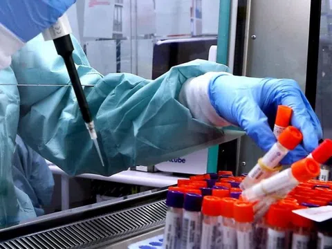 Toàn cảnh vụ thất lạc 300 lọ virus nguy hiểm chết người ở Australia