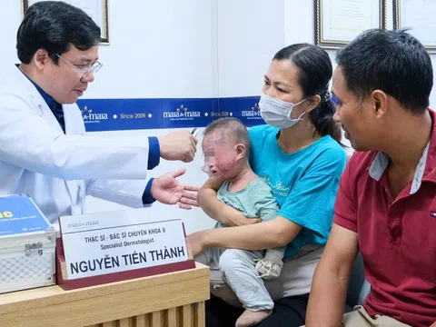 Bé trai 1 tuổi phồng rộp cả mặt, chảy dịch vì viêm da cơ địa