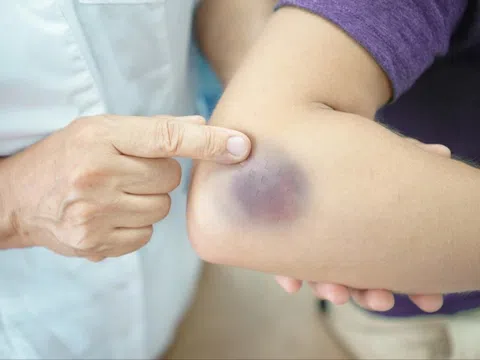 Dấu hiệu đơn giản nhưng cảnh báo gan, thận gặp nguy