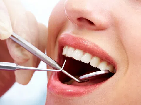 Nên nhổ răng khôn khi nào?