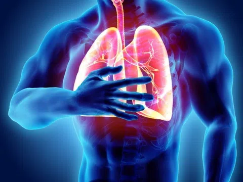 Sai lầm khiến bệnh phổi tắc nghẽn mạn tính trở nặng