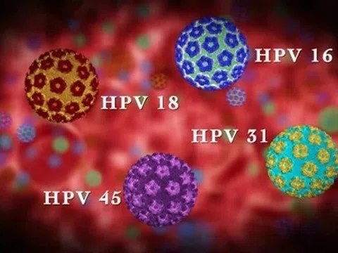 Tiêm vaccine có hiệu quả không nếu đã bị nhiễm virus HPV?