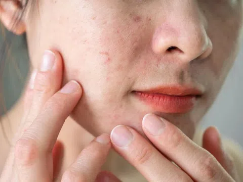 Dấu hiệu quen thuộc giúp người phụ nữ phát hiện ung thư