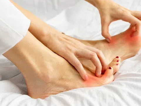 Một dấu hiệu điển hình của bệnh tiểu đường