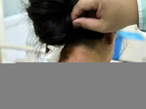 Đau cổ, tê bì một năm không khỏi, người phụ nữ phát hiện bệnh hiếm