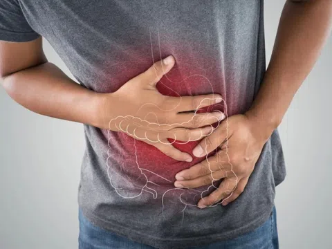 Ung thư đại trực tràng gia tăng toàn cầu, 3 dấu hiệu đáng chú ý