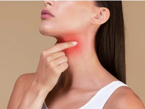 Biện pháp tự nhiên giảm nhanh chứng ngứa họng
