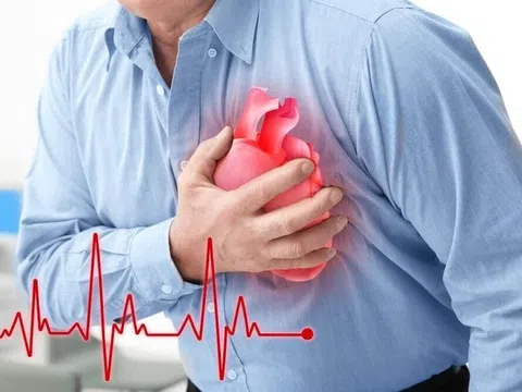 Tức nặng vùng trước tim, tê tay trái là biểu hiện tim thiếu máu cục bộ