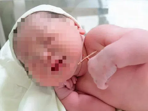 Bé gái 'vượt chông gai' chào đời cùng vòng tránh thai của mẹ
