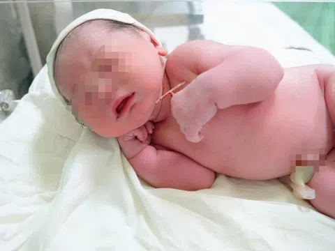 Em bé chào đời cùng vòng tránh thai của mẹ