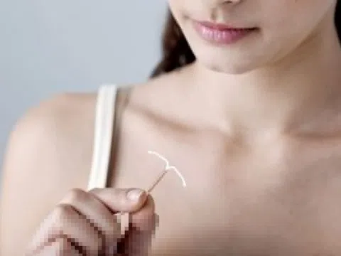 Thời điểm phù hợp để đặt vòng tránh thai
