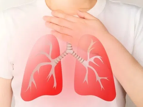 4 mức độ khó thở của hen phế quản