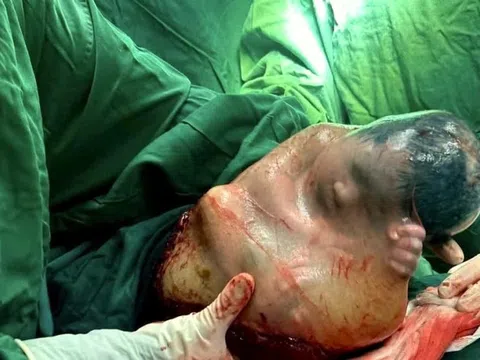 'Em bé may mắn' chào đời kỳ diệu, chục nghìn ca mới có một