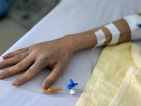Nguyên nhân khiến ngày càng nhiều người mắc ung thư