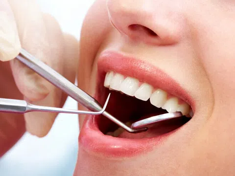 Răng khôn khi nào cần nhổ, nên nhổ ở tuổi nào?