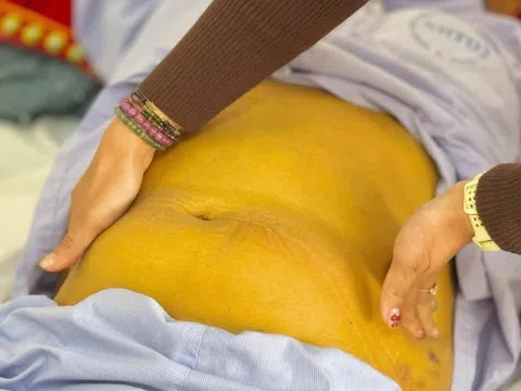Gánh hậu quả vì một quyết định sai lầm khi mắc viêm gan B