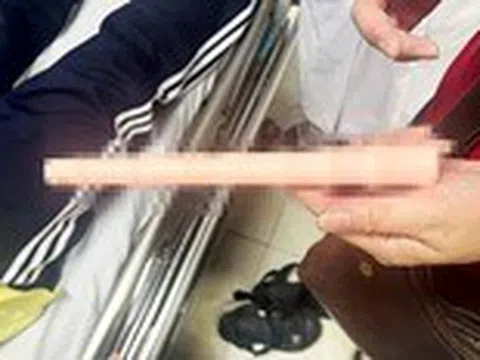 Bệnh nhân cấp cứu liên tục vì hiếu kỳ... đồ chơi tình dục