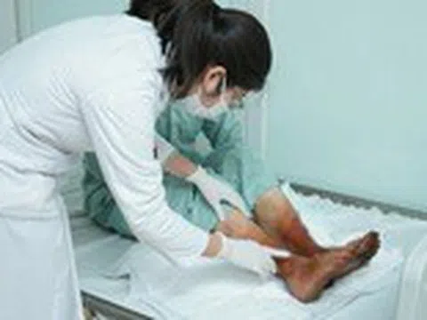 Hoại tử chân vì nghe theo quảng cáo ngâm bột lá thuốc giữ ấm