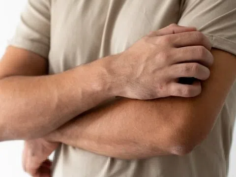 Dấu hiệu cơ thể kháng Insulin, nên biết để đề phòng sớm
