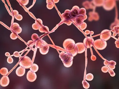 Nhiễm nấm Candida có gây vô sinh không?