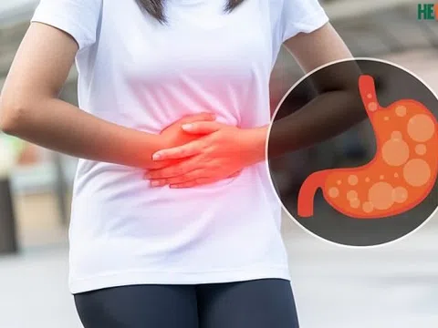 Khắc phục chứng đầy bụng khó tiêu tại nhà