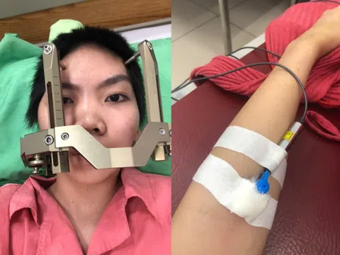 Bỏ qua dấu hiệu cảnh báo, cô gái đột quỵ ở tuổi 22