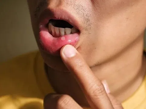 8 dấu hiệu cảnh báo đường ruột chứa đầy độc tố