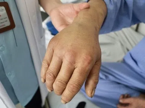 Tin lời 'thần y', người đàn ông nhập viện trong đau đớn