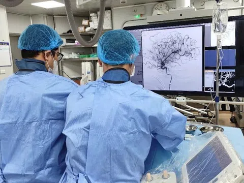 Có dấu hiệu đột quỵ sớm nhưng người đàn ông không hay biết