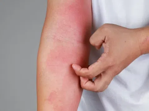 Nguyên nhân khiến da thường xuyên bị khô, ngứa