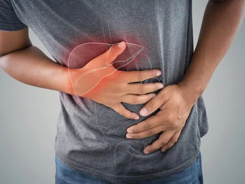 Vợ bị viêm gan A, chồng có nguy cơ mắc bệnh không?
