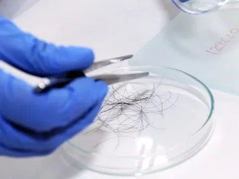 Xét nghiệm ADN con trai, chồng phát hiện bí mật của vợ