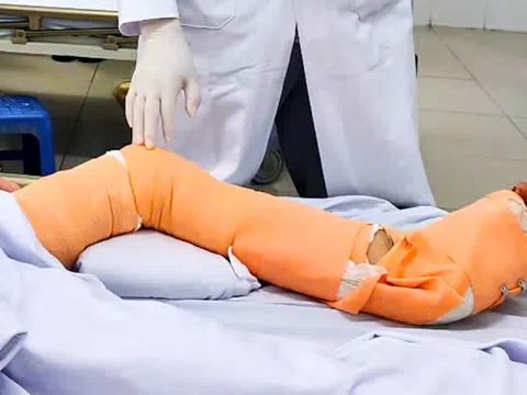 Người lái tàu biển suýt bị cắt bỏ chân vì ‘vi khuẩn ăn thịt người’