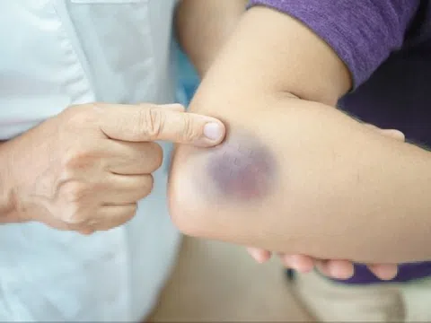 8 dấu hiệu trên da cảnh báo thận đang dần suy giảm chức năng