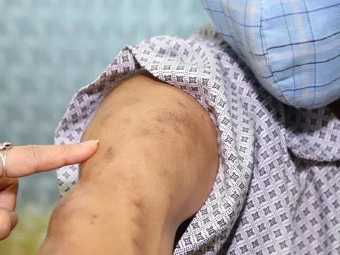 Đau như điện giật, người đàn ông bất ngờ khi biết lý do