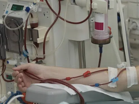 Sở Y tế TP.HCM: Lọc máu thải độc, ngừa đột quỵ là không có cơ sở
