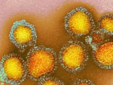 Những điều cần biết về vaccine cúm mùa