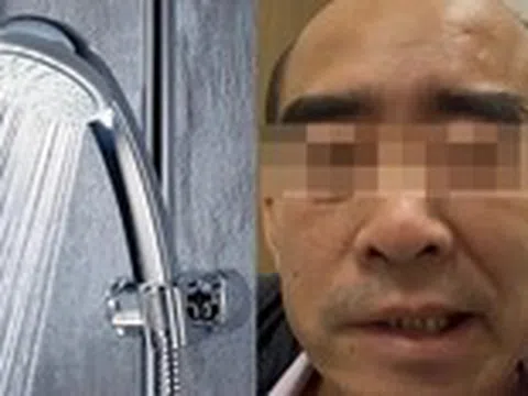 Uống rượu về rồi đi tắm, sáng dậy miệng méo xệch nhưng không do đột quỵ